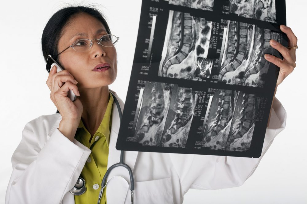 doctor looking at an x-ray while talking on the phone